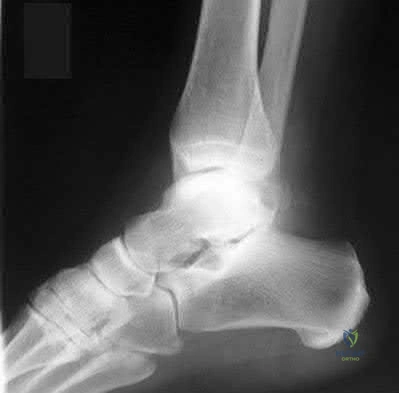Illustration 49 for OrthoCash: Trauma MCQs & Cases for a yearold woman