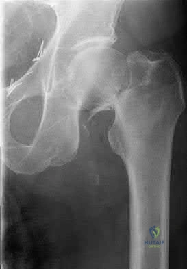 Illustration 32 for OrthoCash: Trauma MCQs & Cases for a yearold woman