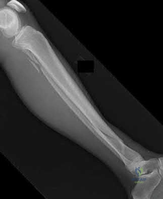 Illustration 195 for OrthoCash: Trauma MCQs & Cases for a yearold woman