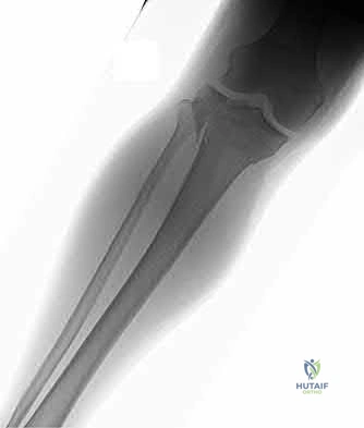Illustration 206 for OrthoCash: Trauma MCQs & Cases for a yearold woman