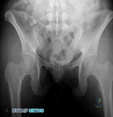 Illustration 193 for OrthoCash: Trauma MCQs & Cases for a yearold woman