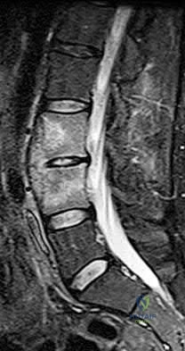 Illustration 19 for OrthoCash: Trauma MCQs & Cases for a yearold woman