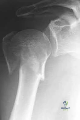 Illustration 69 for OrthoCash: Trauma MCQs & Cases for a yearold woman