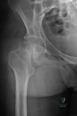 Illustration 17 for OrthoCash: Trauma MCQs & Cases for a yearold woman