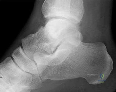 Illustration 156 for OrthoCash: Trauma MCQs & Cases for a yearold woman