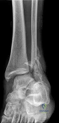 Illustration 94 for OrthoCash: Trauma MCQs & Cases for a yearold woman