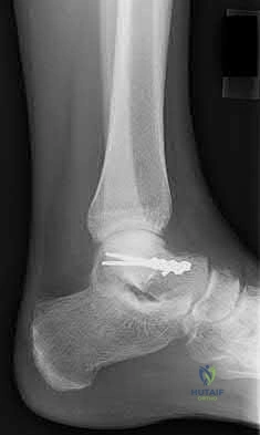 Illustration 121 for OrthoCash: Trauma MCQs & Cases for a yearold woman