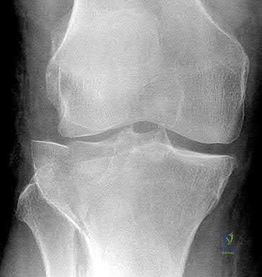 Illustration 24 for OrthoCash: Trauma MCQs & Cases for a yearold woman