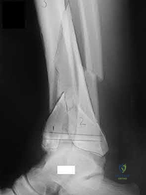 Illustration 96 for OrthoCash: Trauma MCQs & Cases for a yearold woman
