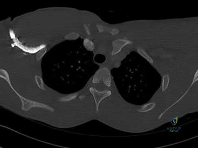 Illustration 45 for OrthoCash: Trauma MCQs & Cases for a yearold woman