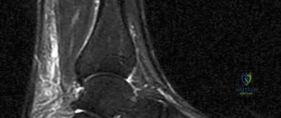 Illustration 106 for OrthoCash: Trauma MCQs & Cases for a yearold woman