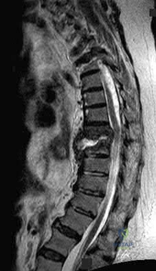 Illustration 9 for OrthoCash: Trauma MCQs & Cases for a yearold woman