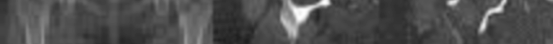 Orthopedic Hand & Wrist MCQs: Online Exam & Study Questions