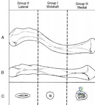 Illustration of orthopaedic basic science - Dr. Mohammed Hutaif