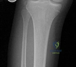 Illustration of correct answer q - Dr. Mohammed Hutaif