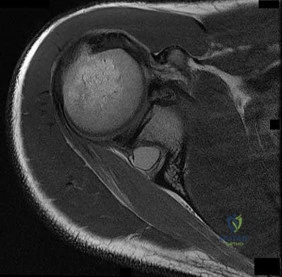 Pediatric Orthopaedic Scored And Re Review | Dr Hutaif - ...