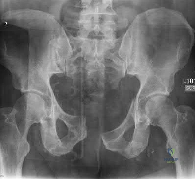 Orthopedic Surgery Mock Exam - Set B3CDB8