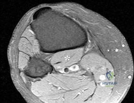 Illustration of resp is question - Dr. Mohammed Hutaif