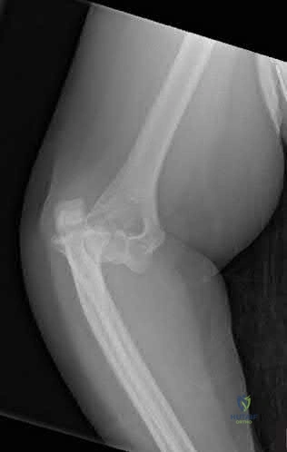 Orthopedic Surgery Mock Exam - Set BD61F5