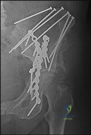 Orthopedic Surgery Mock Exam - Set EA6994