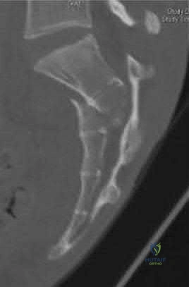 Orthopedic Surgery Mock Exam - Set ECD517