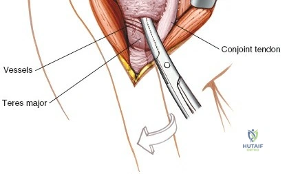 Orthopedic Prometric MCQs - Chapter 4 Part 1