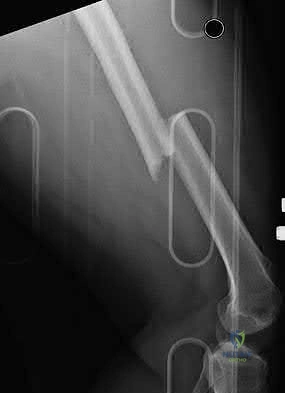 Orthopedic MCqs