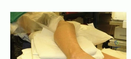 Illustration of low body weight - Dr. Mohammed Hutaif