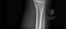 Solve Hand & Wrist Cases: An Orthopedic Question of Figures