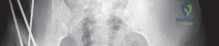 توثيق 13