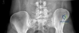 Clinical Image
