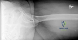 Clinical Image