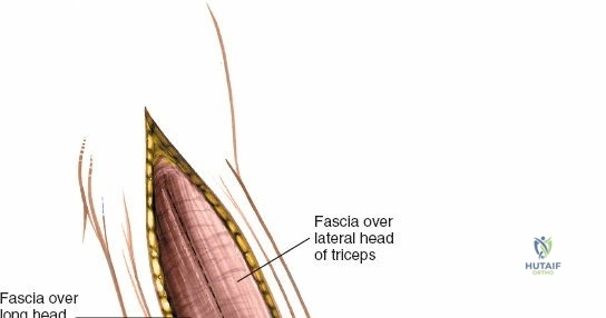 Clinical Image