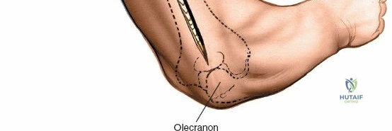 Clinical Image