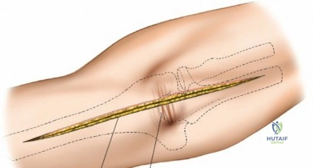 Clinical Image