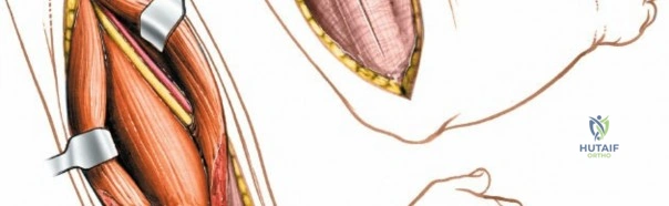 Clinical Image
