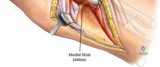 Clinical Image