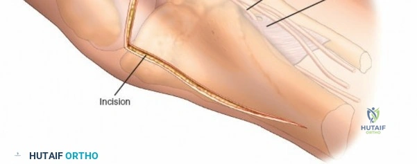 Figure 21: Patient performing gentle knee flexion and extension exercises.