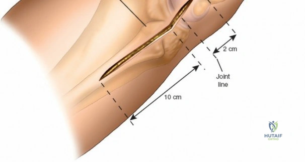 Clinical Image