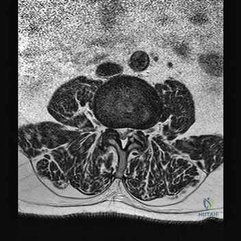 Illustration 21 for Ace FRCS Orthopaedics: Oxford University Press Adult Pathology Viva