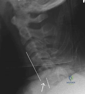 Illustration 14 for Ace Your FRCS: Key Questions in Trauma & Orthopaedics