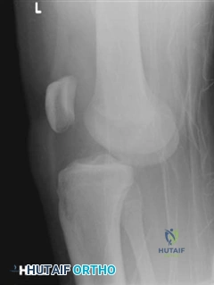 Illustration 7 for Ace Your FRCS: Key Questions in Trauma & Orthopaedics