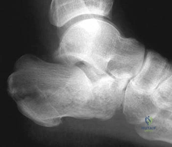 Illustration 4 for Ace Your FRCS: Key Questions in Trauma & Orthopaedics