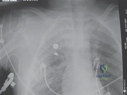 Illustration 9 for Ace Your FRCS: Key Questions in Trauma & Orthopaedics