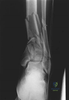 Illustration 6 for Ace Your FRCS: Key Questions in Trauma & Orthopaedics
