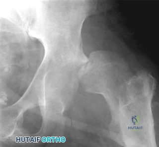 Illustration 8 for Ace Your FRCS: Key Questions in Trauma & Orthopaedics
