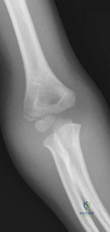 Illustration 19 for Ace Your FRCS: Key Questions in Trauma & Orthopaedics
