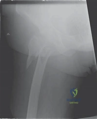 Illustration 12 for Ace Your FRCS: Key Questions in Trauma & Orthopaedics