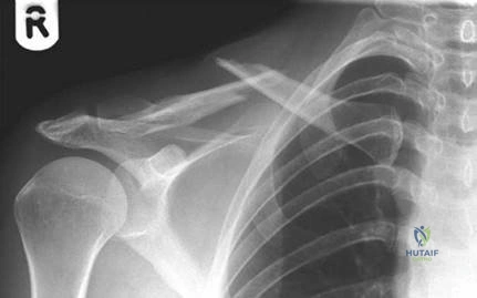 Illustration 18 for Ace Your FRCS: Key Questions in Trauma & Orthopaedics