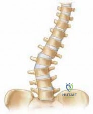 Real-life stories of patients who underwent orthopedic surgeries by Prof. Dr. Mohammad Hutaif